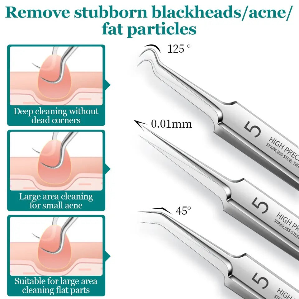 Professional Facial Blackhead Remover Tweezers - 3Pcs Set